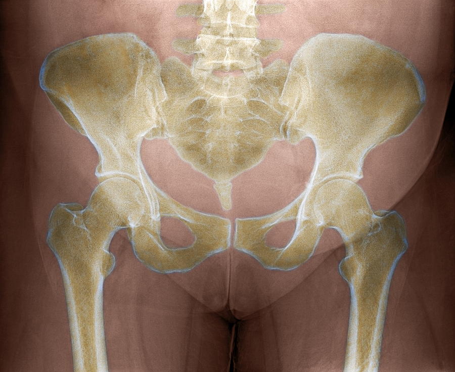 female-pelvis-x-ray-du-cane-medi