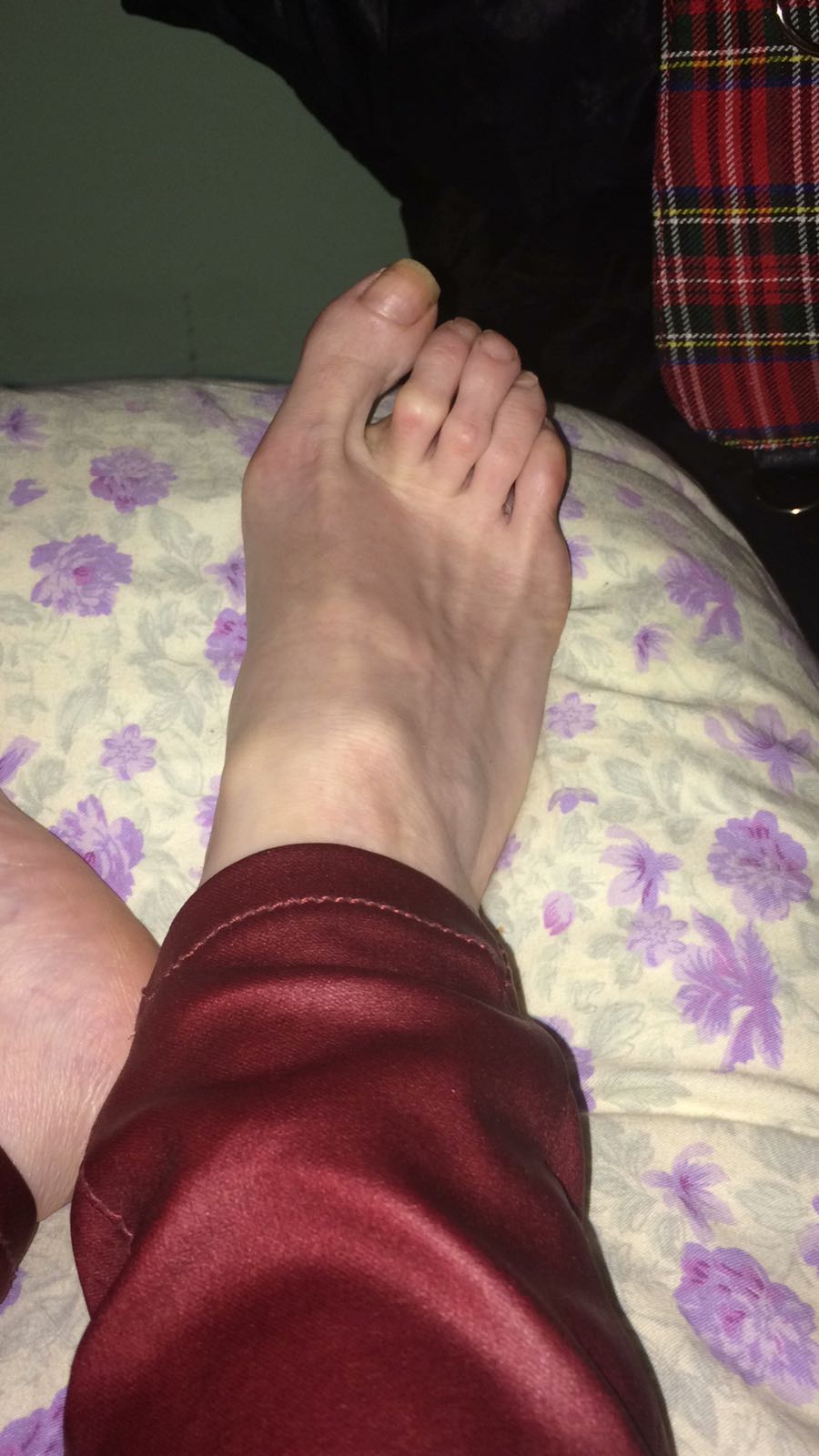 feet1